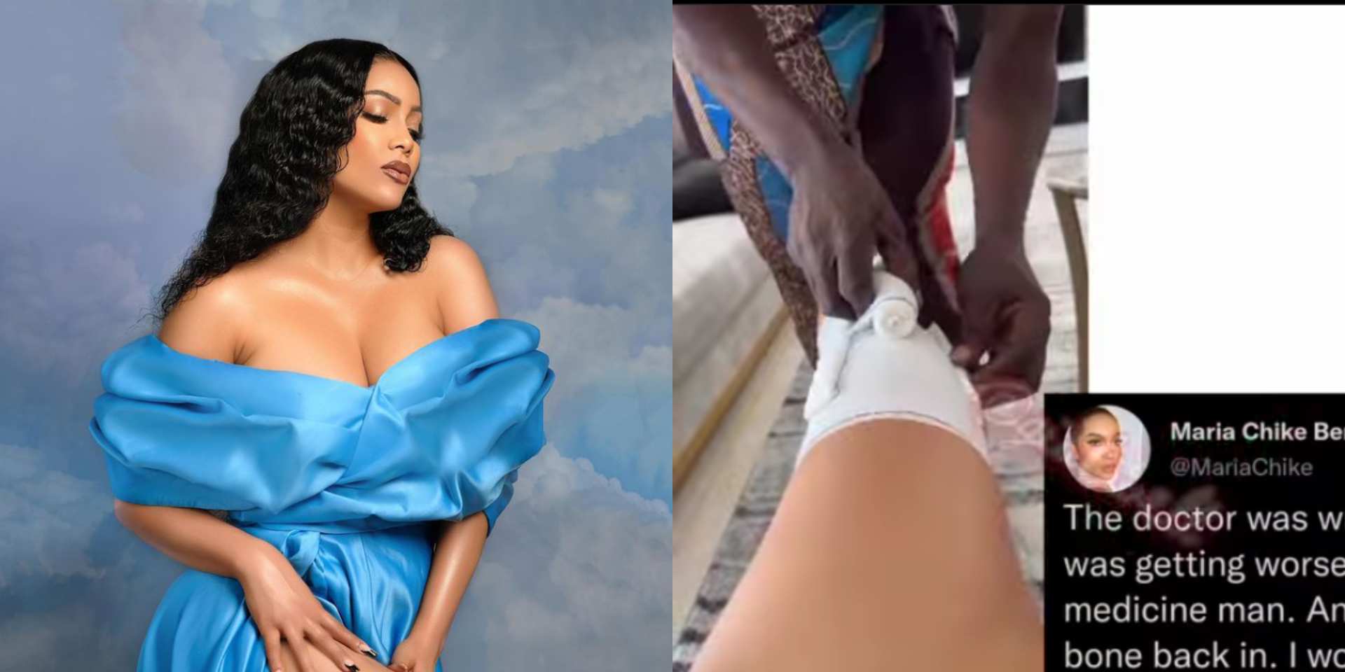 Maria visits native doctor as medical practitioners fail to treat her knee dislocation [Video]