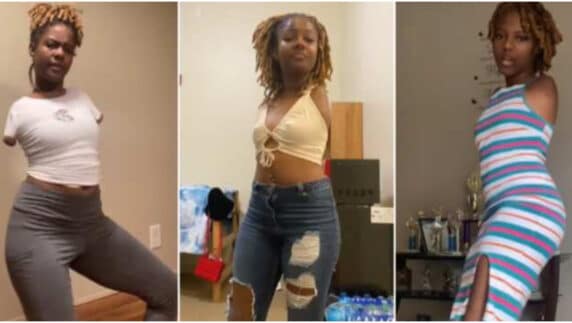 21-year-old lady without hands creates her own happiness, swings her waist sweetly to music (Video)