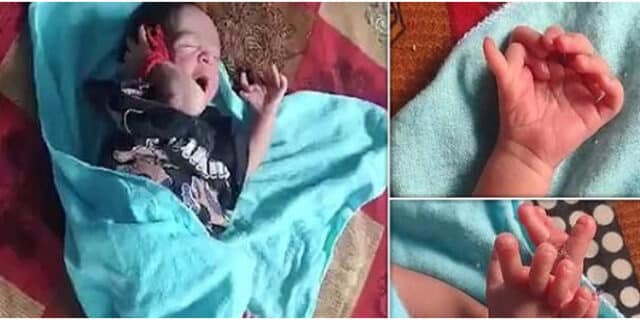 Baby born with 26 fingers, family calls her incarnation of goddess