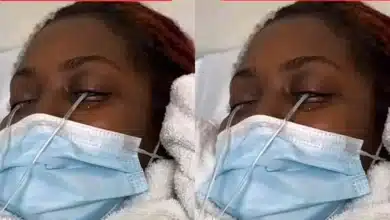 “They had to flush her eyes out 4 times” — Lady nearly goes blind as she fixes lashes