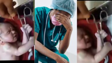 "Future warrior" - Internet buzzes over newborn baby's strong hold on forceps during umbilical cord cutting