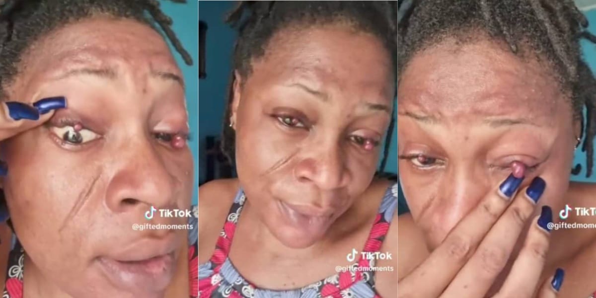 "It's becoming scary" – Lady shares how pregnancy affected her eyes