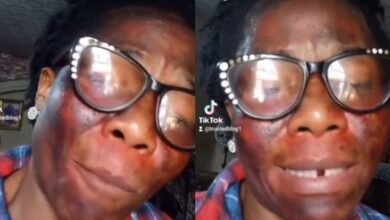 My husband's side chic gave me acid as organic product for face - Woman alleges