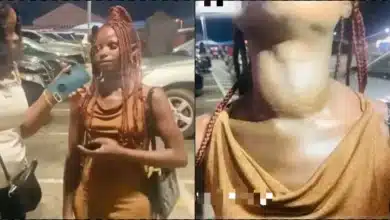 Nigerians crowdfund for lady who does hookup to raise money for goitre surgery