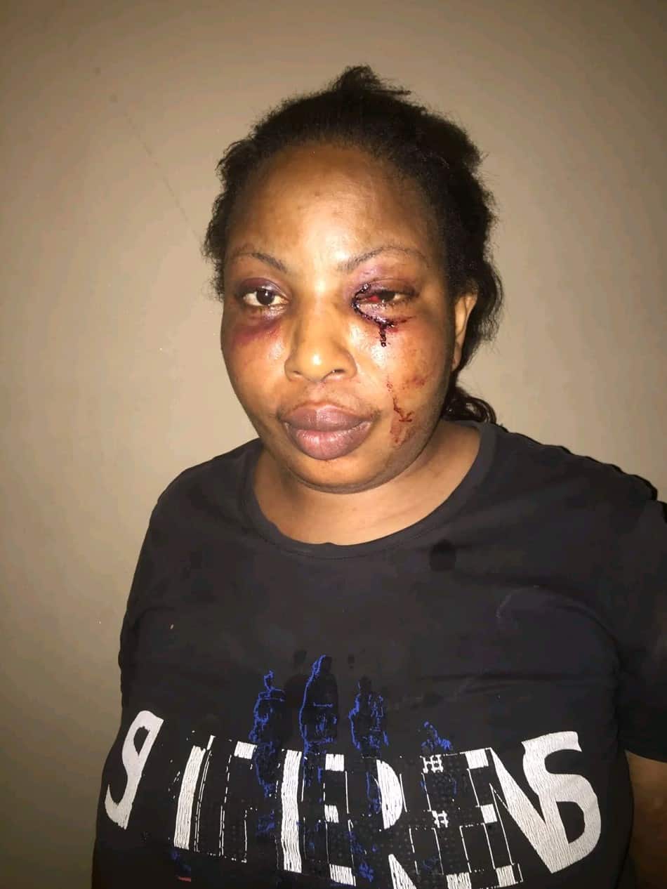 Lady shares photos of injuries she sustained after being assaulted by drunk 'baby daddy'