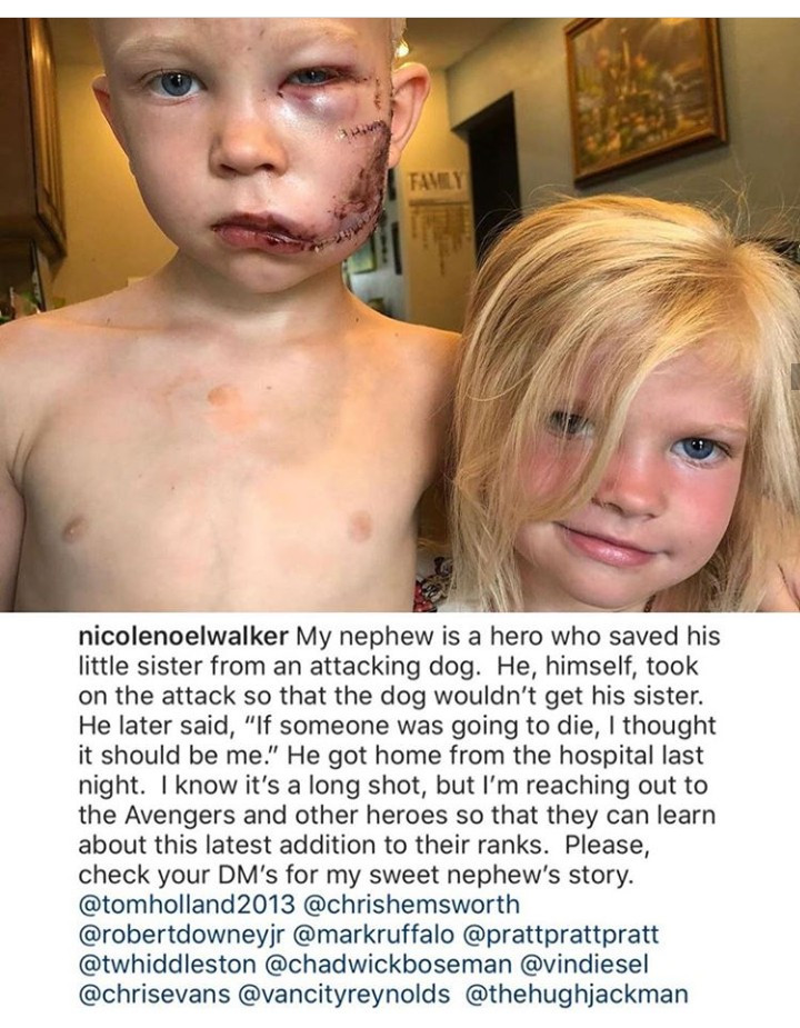 6-year-old boy risks his life to save sister from brutal dog att 