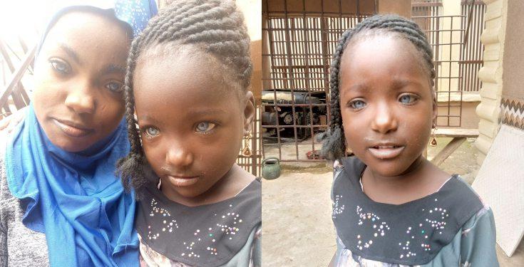 Kwara man allegedly rejects his daughter because she has blue eyes