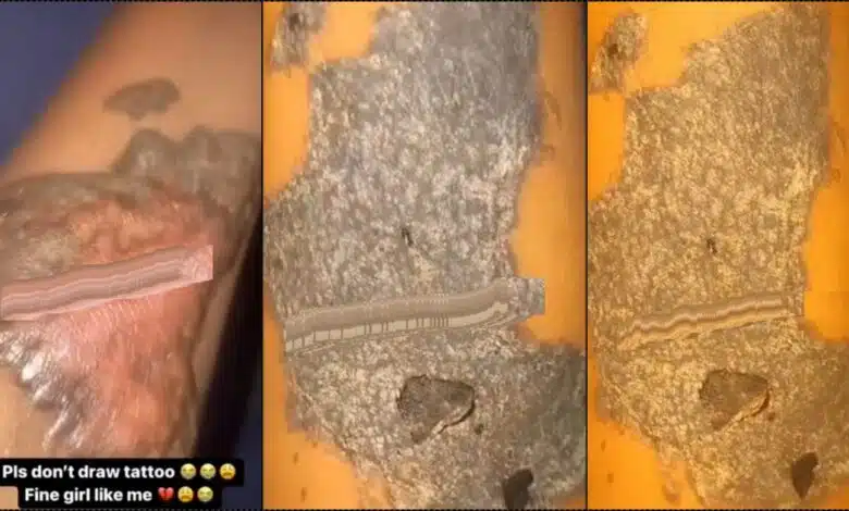 "Please don't draw tattoo" — Lady pleads as she shares painful experience (Video)