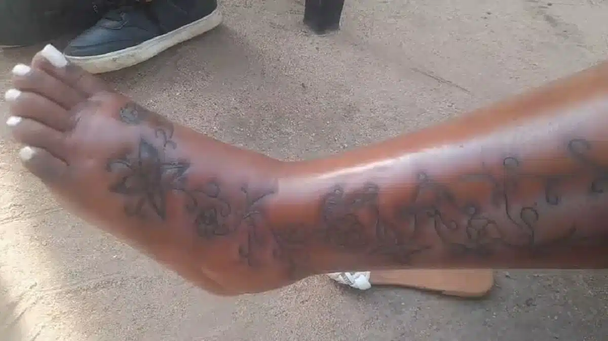 Lady in pain as she contracts infection from tattoo (Video)