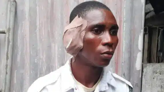 Drama as angry driver bites off VIO officer’s ear in Delta