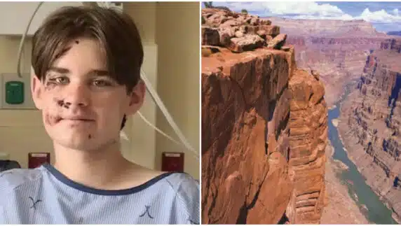 "Miraculous survival" - 14-year-old boy survives 100-ft fall into Grand Canyon