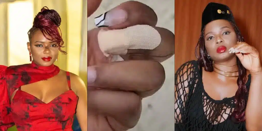 "I only lost a nail" - Yemi Alade says as she survives car accident in Spain