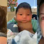 Woman shares how giving birth to her baby explodes her face blood vessels