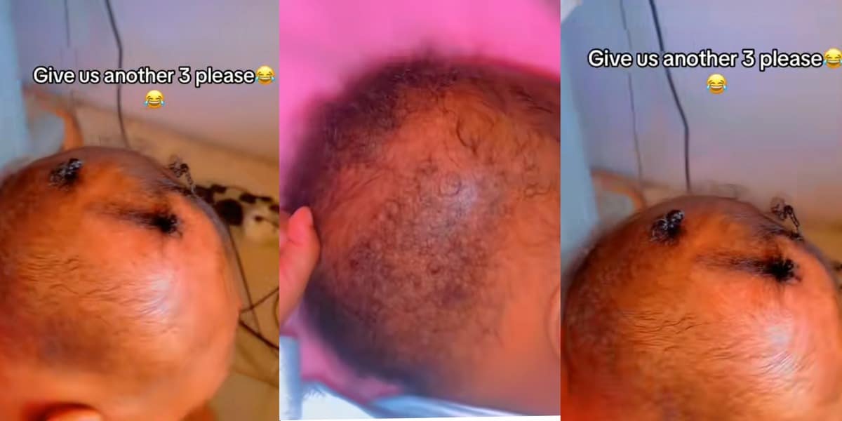 "Put it in rice" - Lady causes laughter, advises mother to put daughter's head in rice because her hair refuses to grow