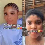 Lady shares transformation after involvement in ghastly accident