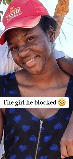 "He's regretting now" - Lady stuns many with her transformation after being dumped by boyfriend over skin issue