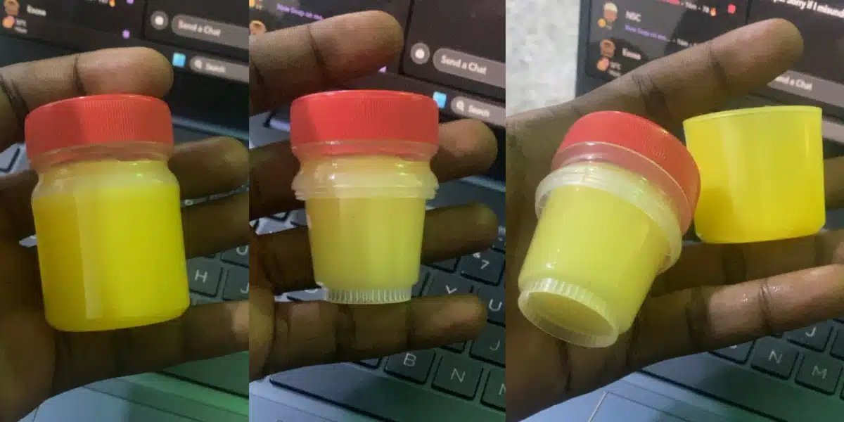 “Daylight robbery” — Man cries out after being deceived by popular ointment packaging