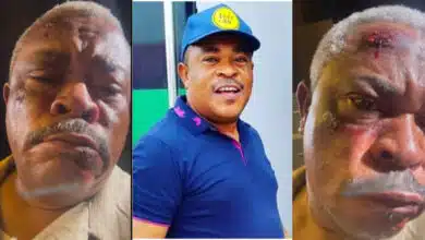 Victor Osuagwu sparks concerns after he shared video showing his bruised face