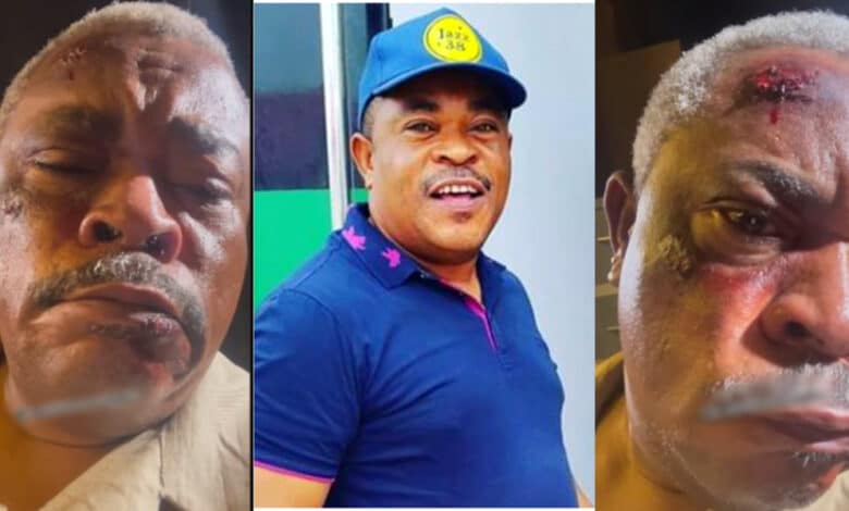 Victor Osuagwu sparks concerns after he shared video showing his bruised face