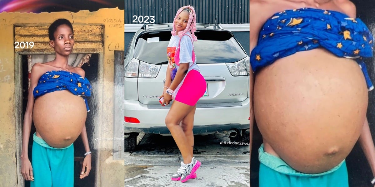 Mystery as Nigerian lady shares before and after photos