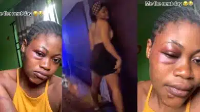 Nigerian lady shares evidence of what her father did to her after seeing her club video