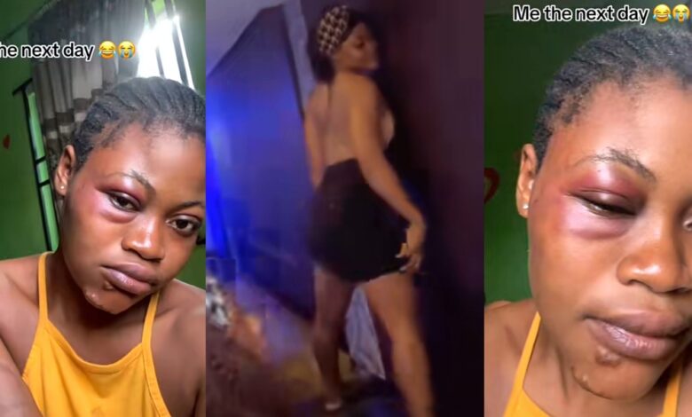 Nigerian lady shares evidence of what her father did to her after seeing her club video