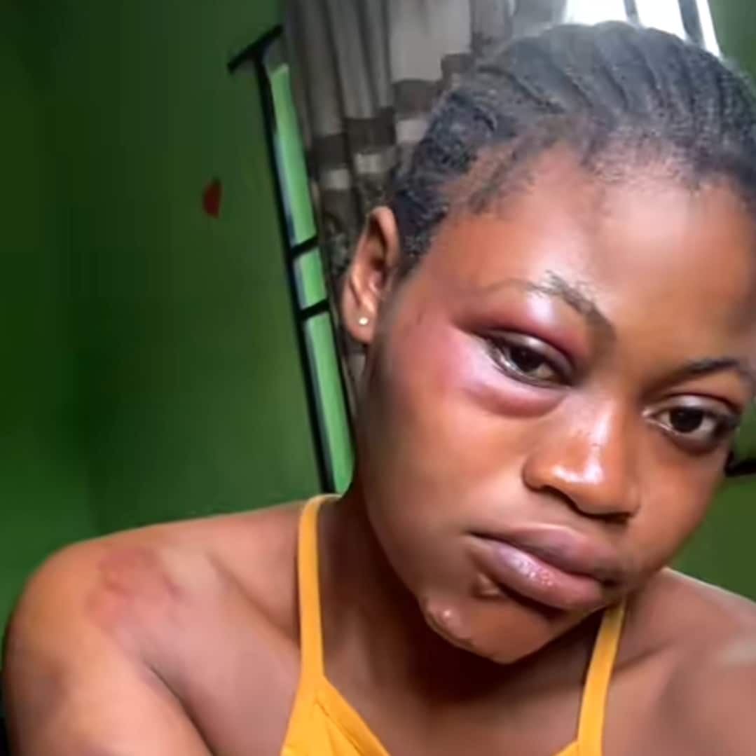 Nigerian lady shares evidence of what her father did to her after seeing her club video