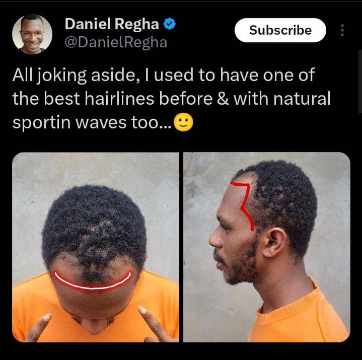 Reactions as Daniel Regha reveals he once had the best hairline