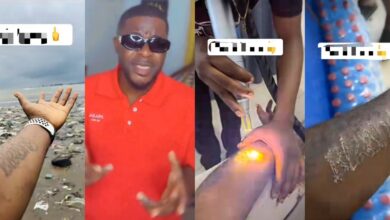 Nigerian man erases girlfriend’s name permanent tattoo after messy breakup, sparks social media buzz