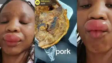 Nigerian woman develops allergy after eating pork, shares shocking video on social media