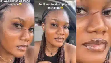 Nigerian lady gets her face redesigned by boyfriend's main girlfriend after unannounced visit to his house