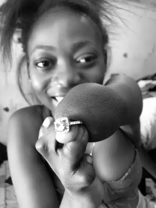 Amputee over the moon as boyfriend proposes to her, flaunts ring online