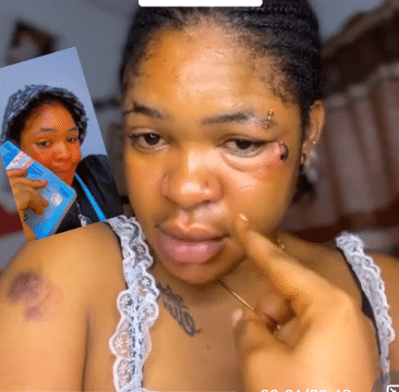 Lady shares what boyfriend did to her face after she requested N150K for wig