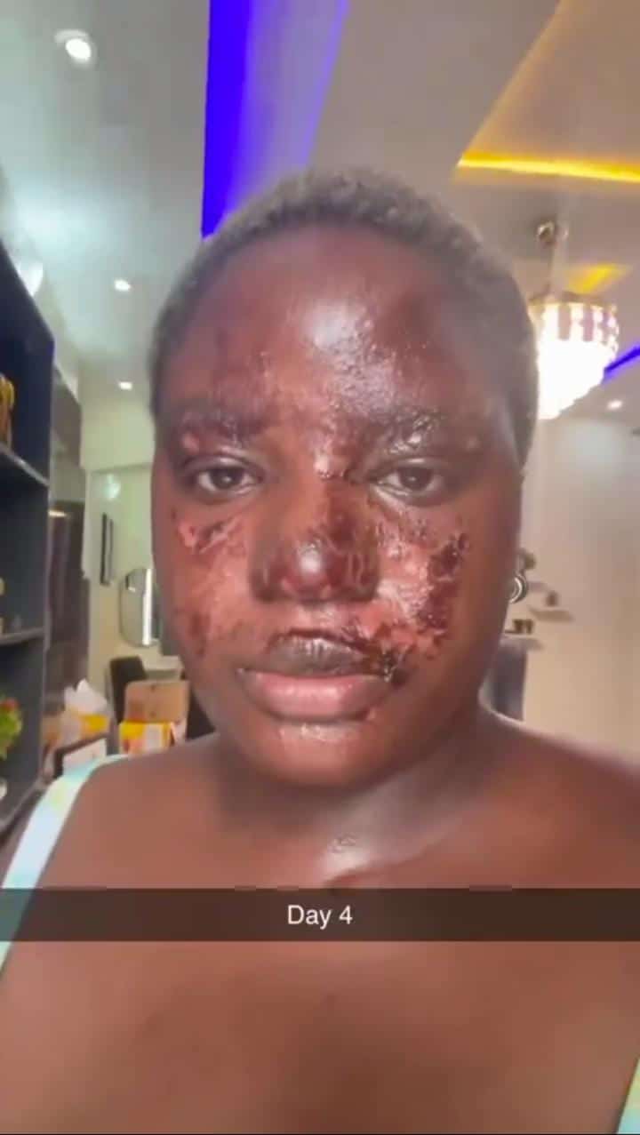Beautiful lady narrates terrifying experience where a pressure pot nearly took her life