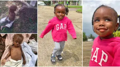 Amazing transformation of toddler who was rescued after being abandoned as a 'witch' goes viral