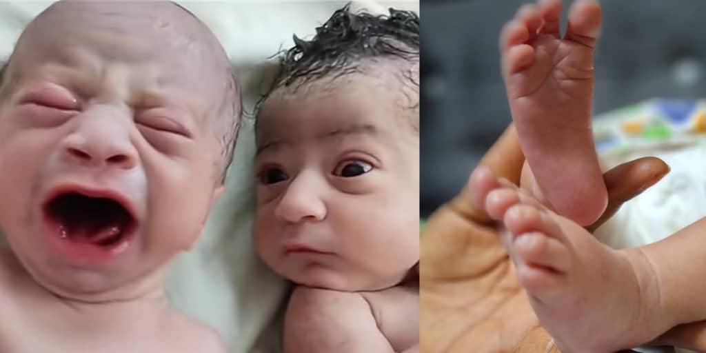 Newborn baby breaks internet with shocking stare at his crying twin brother