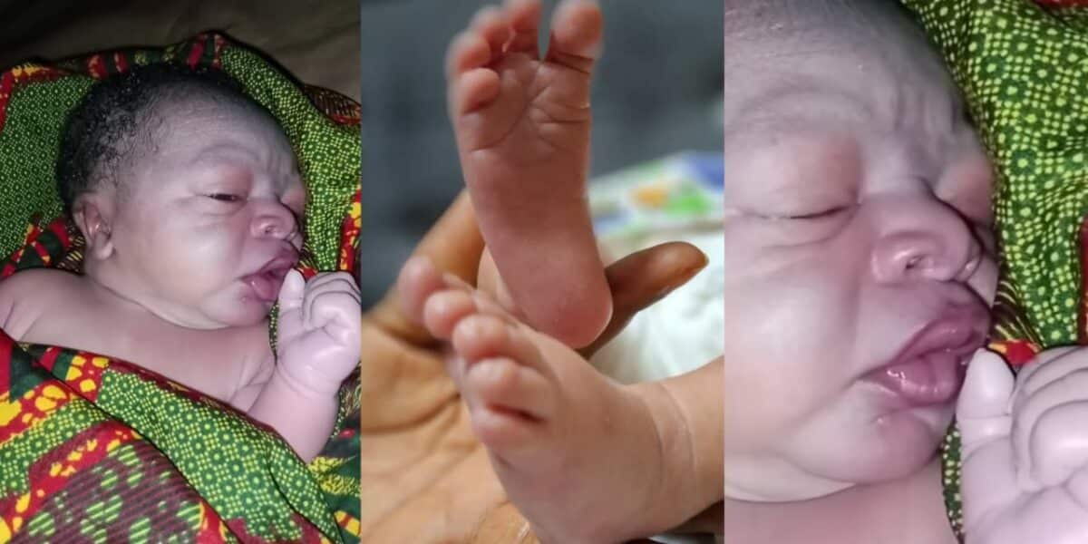 Newborn baby sparks social media reactions with unique facial appearance