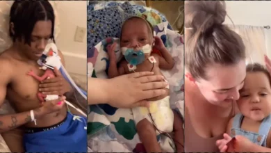 Couple shares heartwarming transformation of their baby