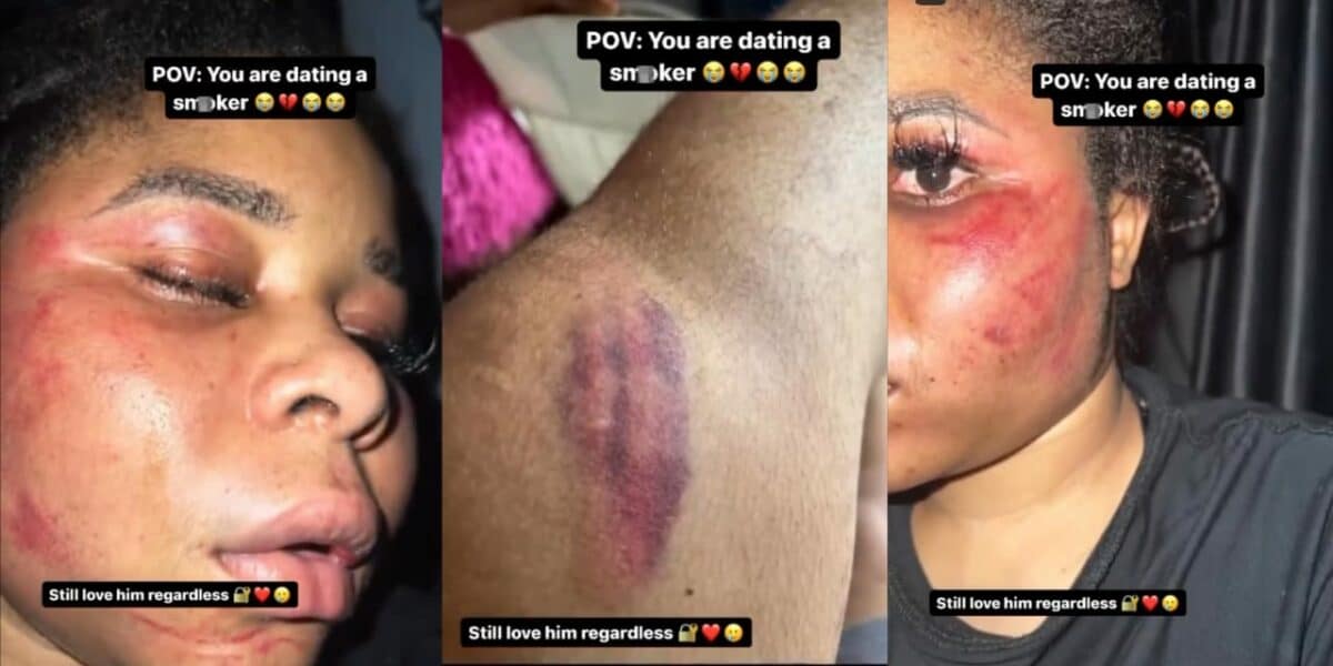 Lady dating a smoker shocks social media with disturbing body reveal