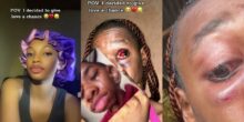 Lady shocks internet with video of severe injuries after giving love a chance