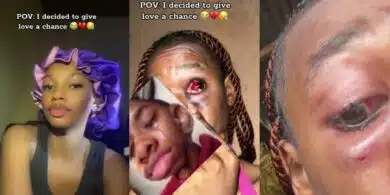 Lady shocks internet with video of severe injuries after giving love a chance