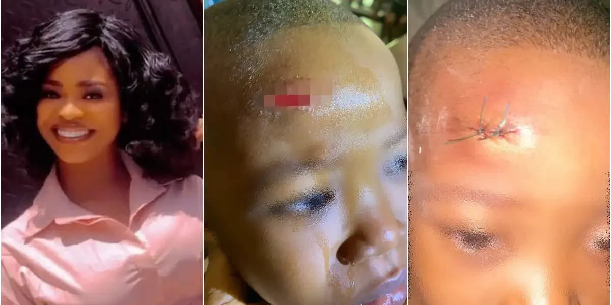 Mother raises alarm over scar on son caused by another student at school