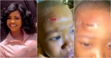 Mother raises alarm over scar on son caused by another student at school