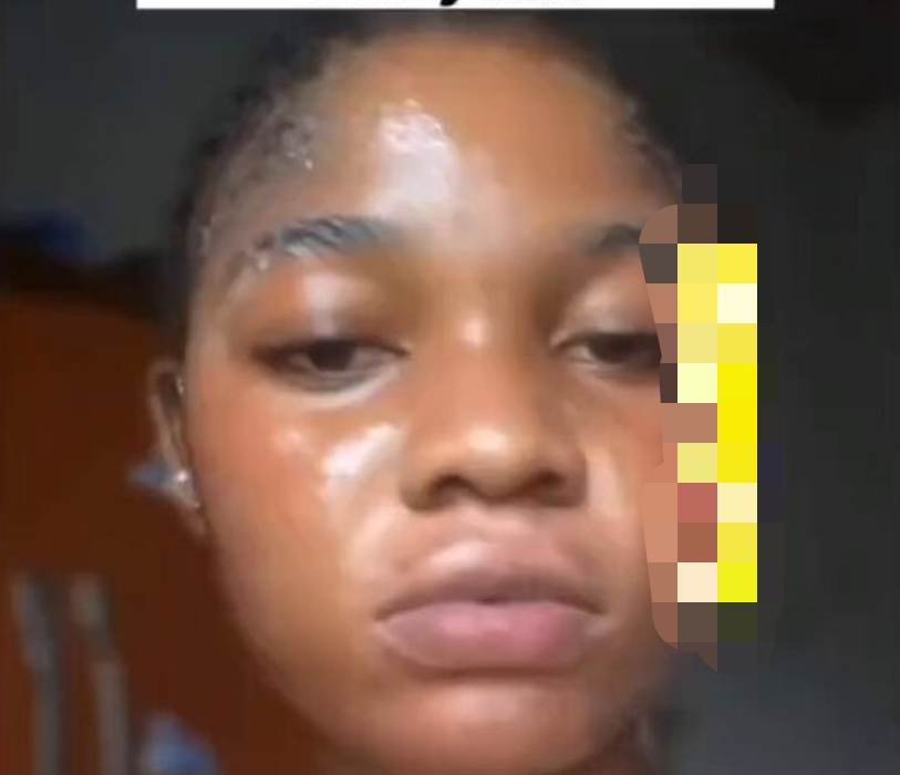 Lady shares shocking skin effects after taking Postinor-2 daily