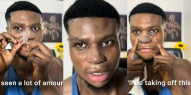 Zic Aloma shares new video 3 weeks after nose surgery, reveals why he did it