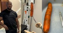 Doctor raises alarm as he shows foreign object he took out of a man's body