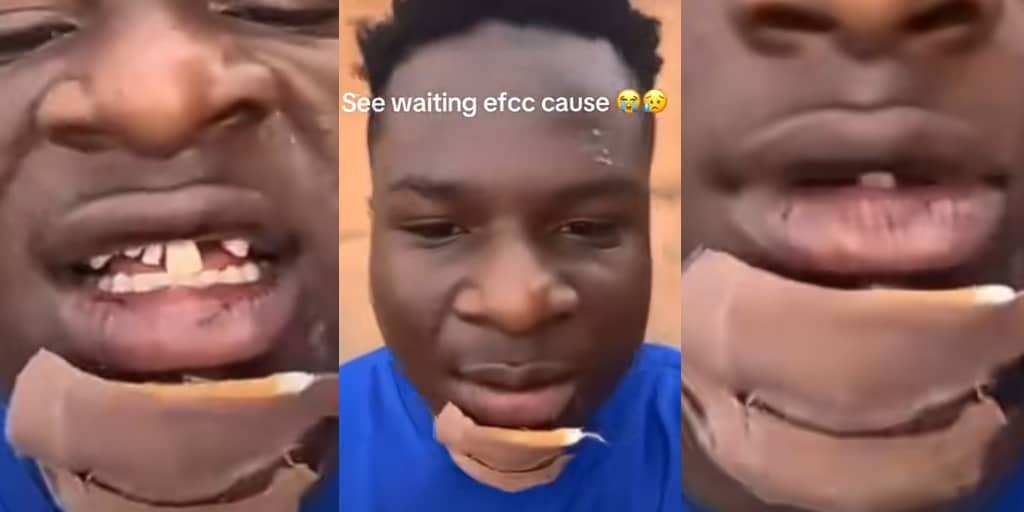 Man breaks jaw and loses teeth while trying to flee from EFCC operatives