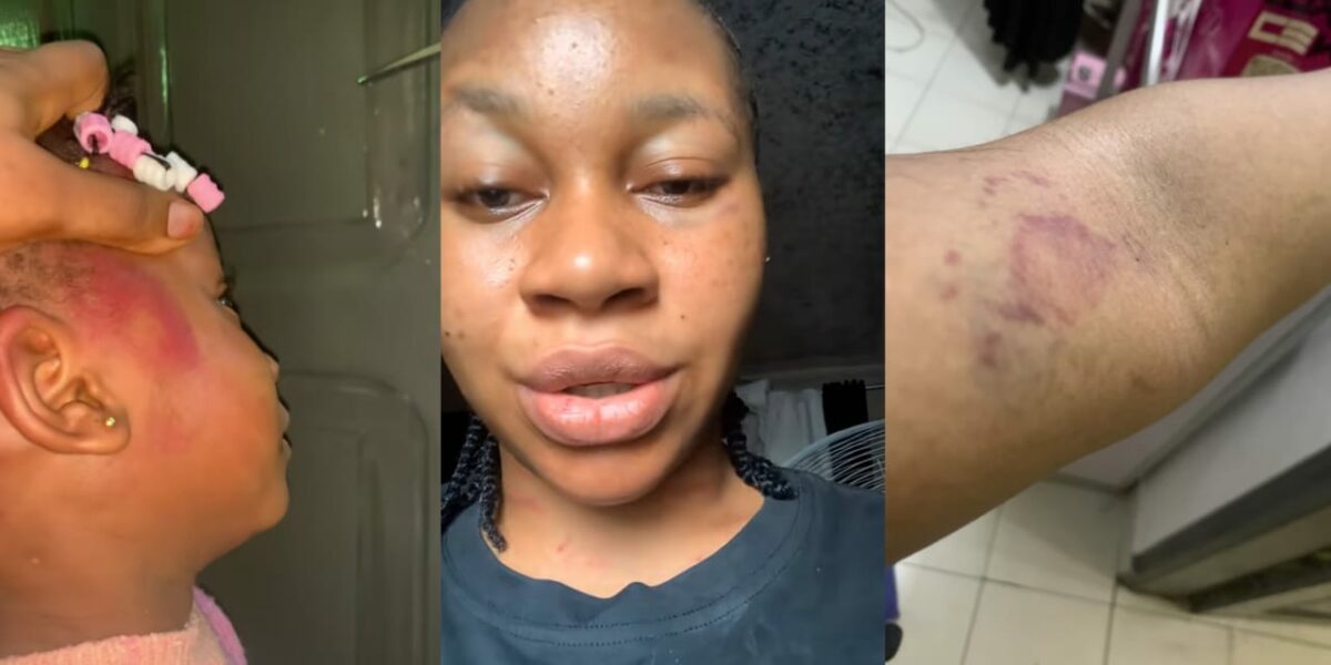 Woman exposes abusive husband who beat her while pregnant, locked her out after miscarriage