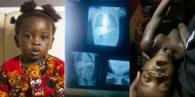 Boy dies after swallowing groundnut as hospital fails to provide tracheostomy tube